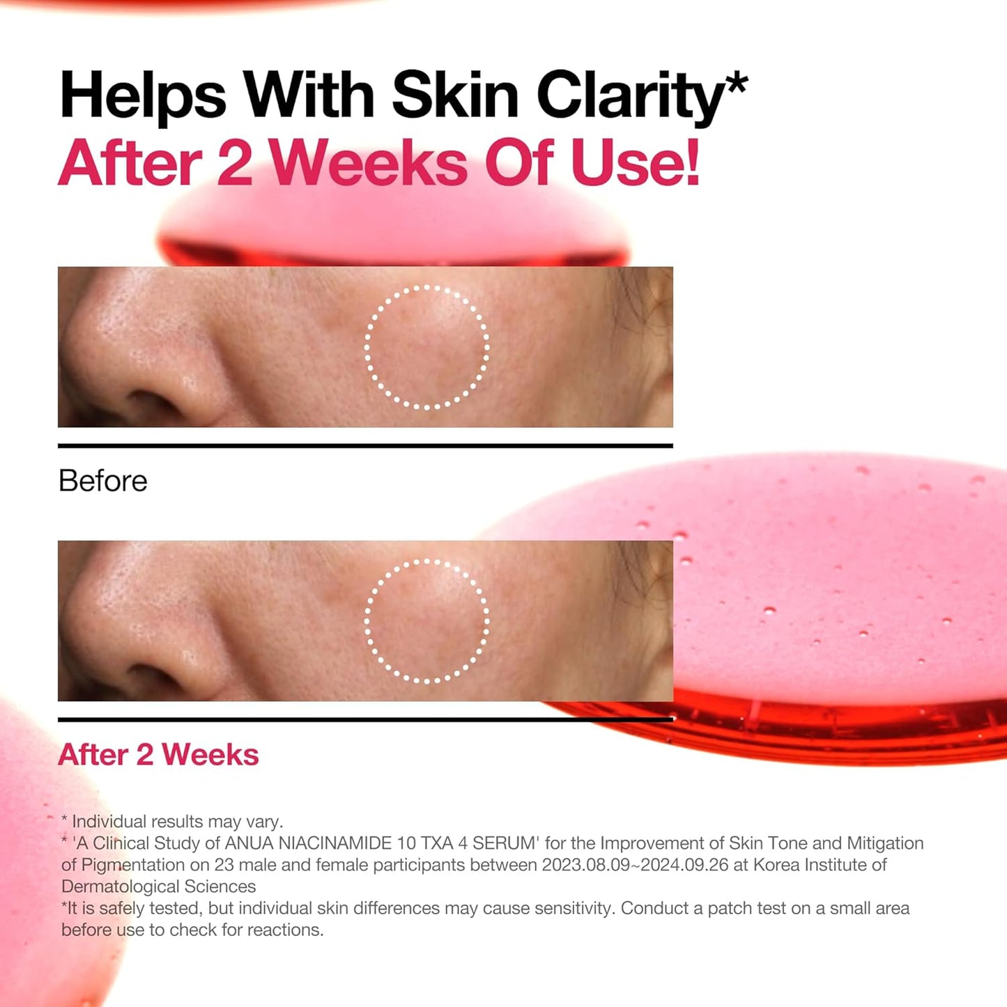 Anua Niacinamide 10% + TXA 4% Serum | 10% Niacinamide & 4% Tranexamic Acid for Brightening & Dark Spot Correction - T.E.R