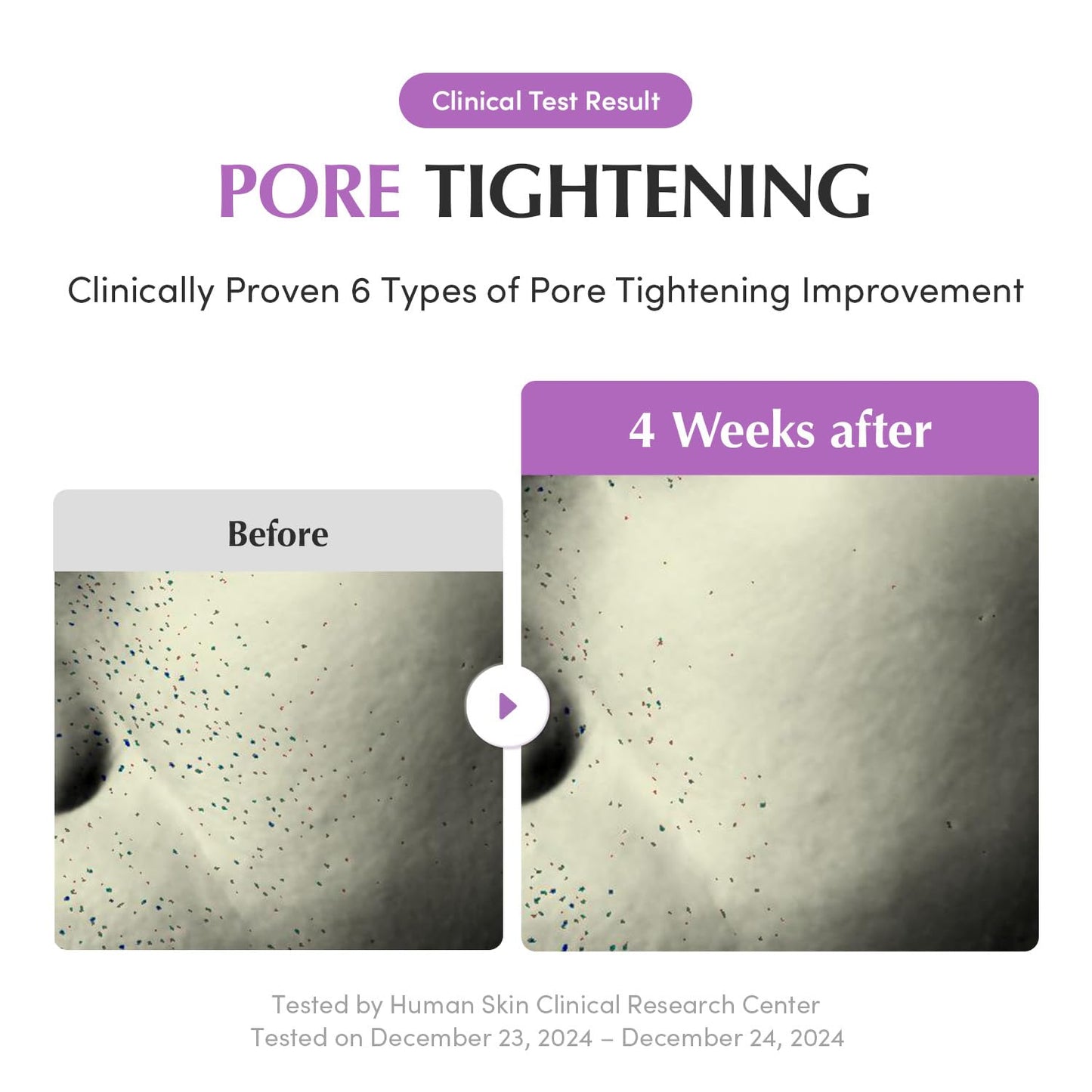Purple PDRN Pore Minimizing Serum 1.01 FL OZ | Vegan Collagen, Peptides, Niacinamide & CICA Exosome | Pore Tightening, Calming & Glass Skin | Korean Skincare - T.E.R