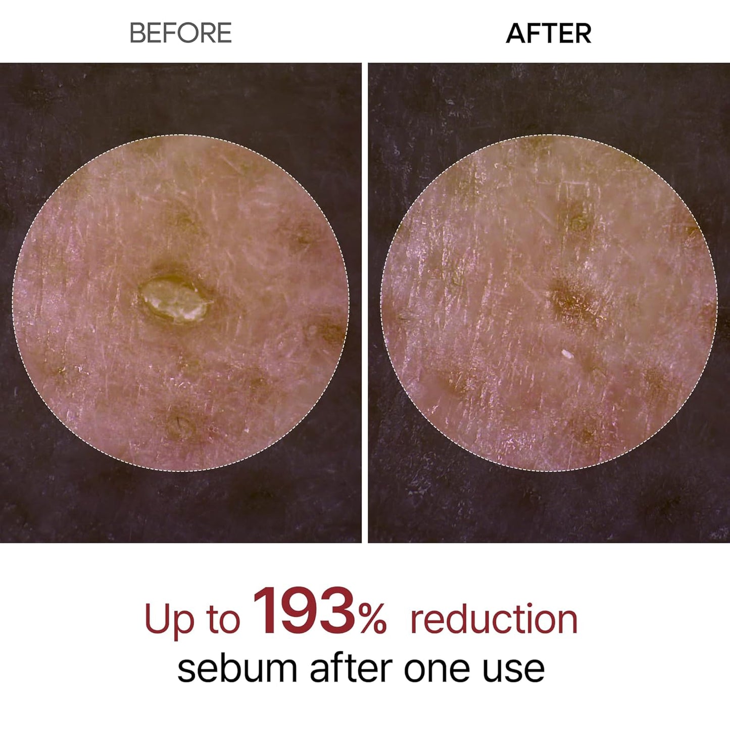 Dr. Melaxin Peel Shot Exfoliating Black Rice Ampoule 80ml | Pore-Refining Rice Water + Niacinamide