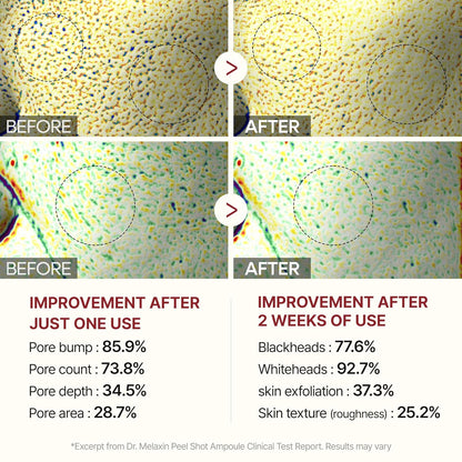 Dr. Melaxin Peel Shot Exfoliating Black Rice Ampoule 80ml | Pore-Refining Rice Water + Niacinamide