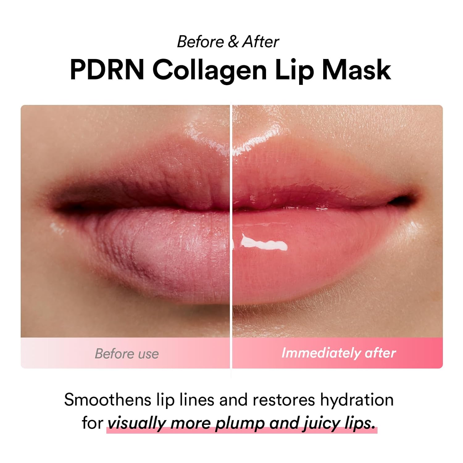 Abib PDRN Collagen Lip Mask Glazed Jelly | Hydrating & Plumping Lip Treatment for Smooth, Glossy, Healthy Lips - T.E.R