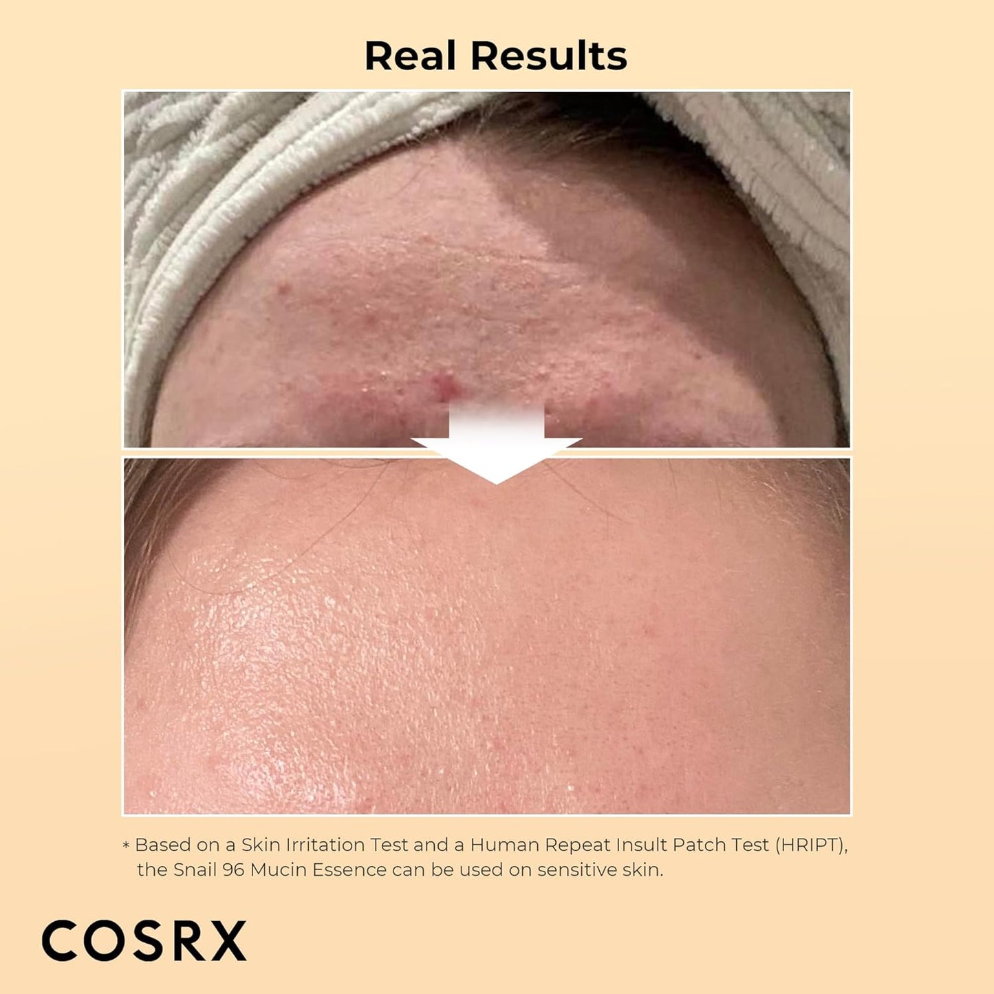 COSRX Advanced Snail 96 Mucin Power Essence: Hydrate and Soothe Your Skin with Snail Mucin - T.E.R