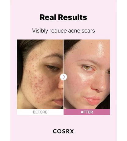 COSRX The Niacinamide 15% Serum | Brightening, Pore - Minimizing & Antioxidant Elixir - T.E.R