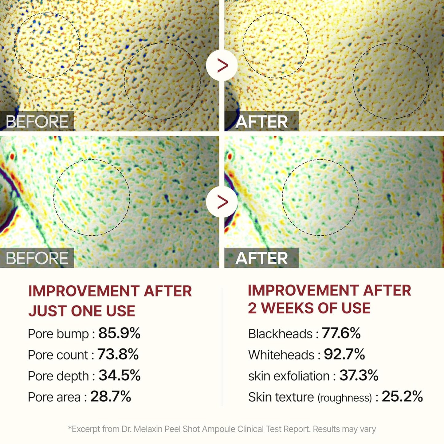 Dr. Melaxin Peel Shot Glow White Rice Ampoule | Dual - Action Rice Peel + Ampoule for Radiant, Smooth Skin - T.E.R