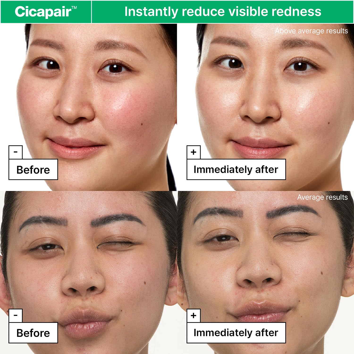 Dr.Jart+ Cicapair™ Sensitive Skin Face Moisturizer | Redness Relief & Barrier Repair Cream with Centella Asiatica – 50ml / 1.69 oz - T.E.R