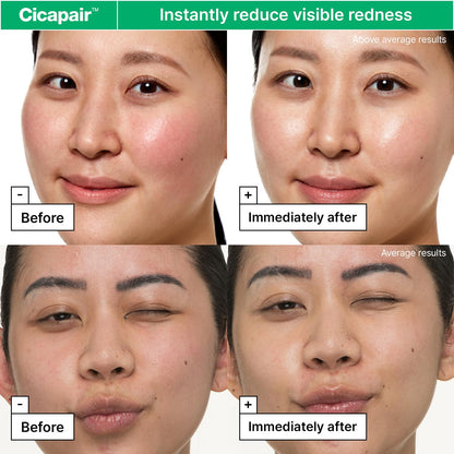 Dr.Jart+ Cicapair™ Sensitive Skin Face Moisturizer | Redness Relief & Barrier Repair Cream with Centella Asiatica – 50ml / 1.69 oz - T.E.R