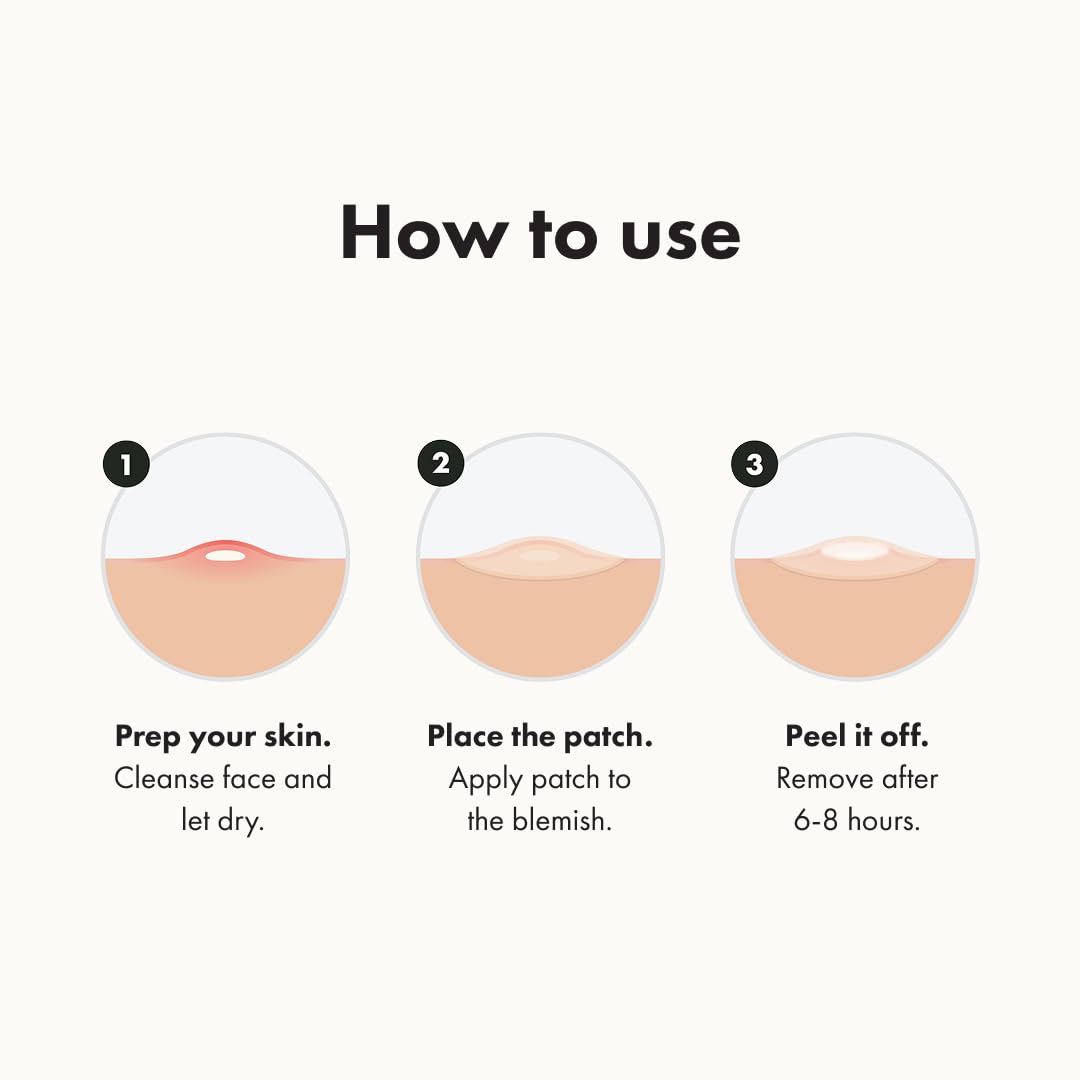 Hero Mighty Patch Original – 36 Hydrocolloid Patches for Whiteheads - T.E.R