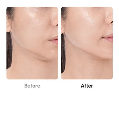 Medicube Age - R Booster Pro | Advanced At - Home Skin Tightening Device Pink - T.E.R