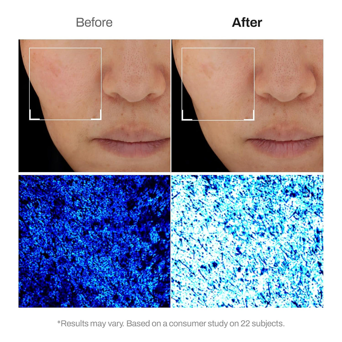 Before and after skin hydration results with Meditherapy Hyaluronic Acid Skin Booster First Serum - moisture map consumer study