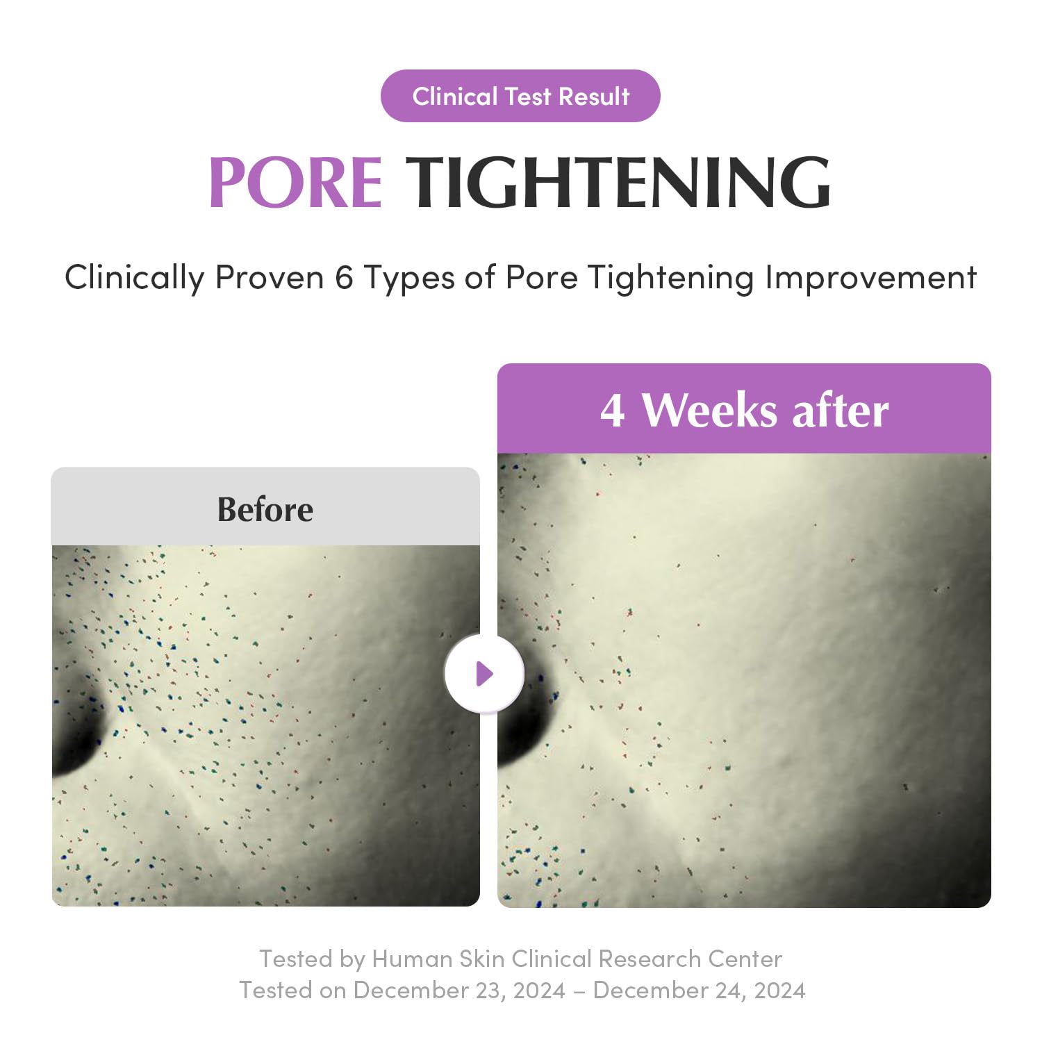 Purple PDRN Pore Minimizing Serum 1.01 FL OZ | Vegan Collagen, Peptides, Niacinamide & CICA Exosome | Pore Tightening, Calming & Glass Skin | Korean Skincare - T.E.R
