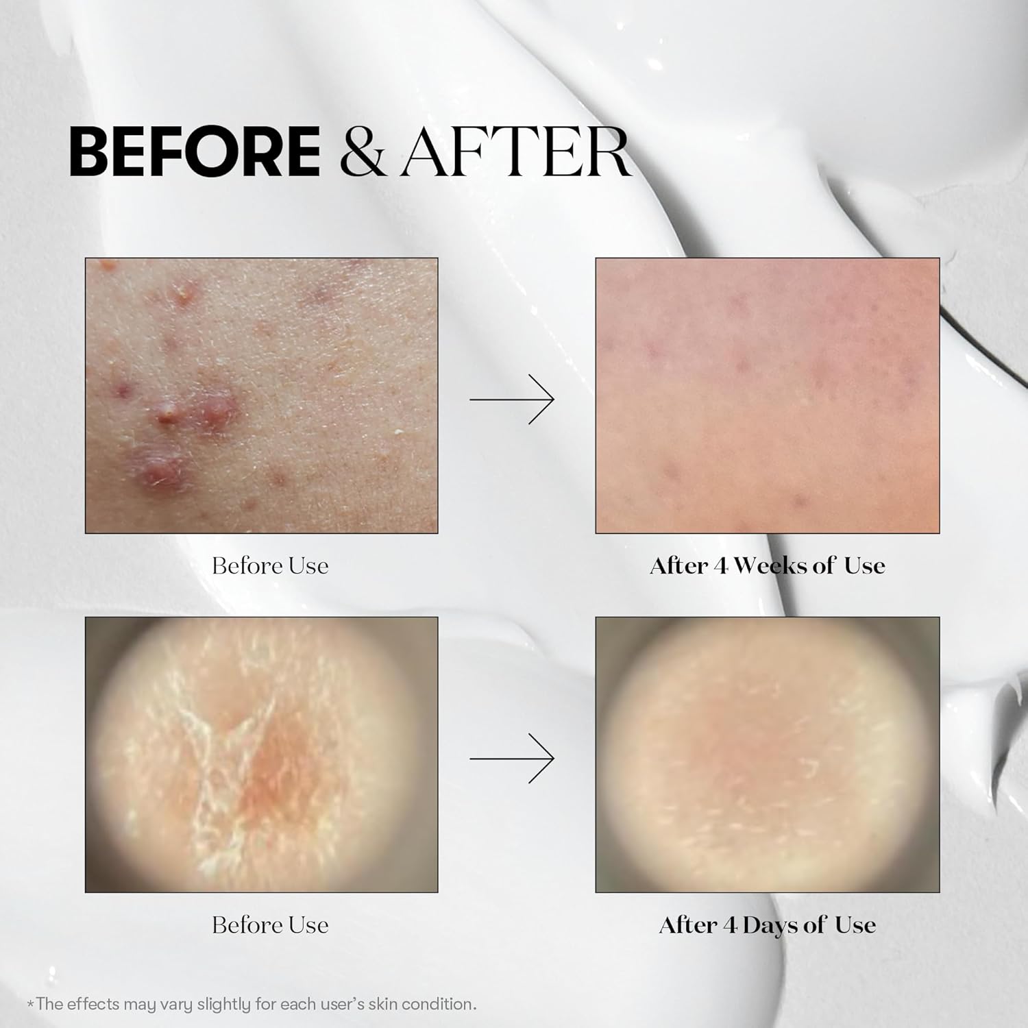 VT COSMETICS CICA Reedle Shot 300 | Advanced Exosome Night Serum - T.E.R