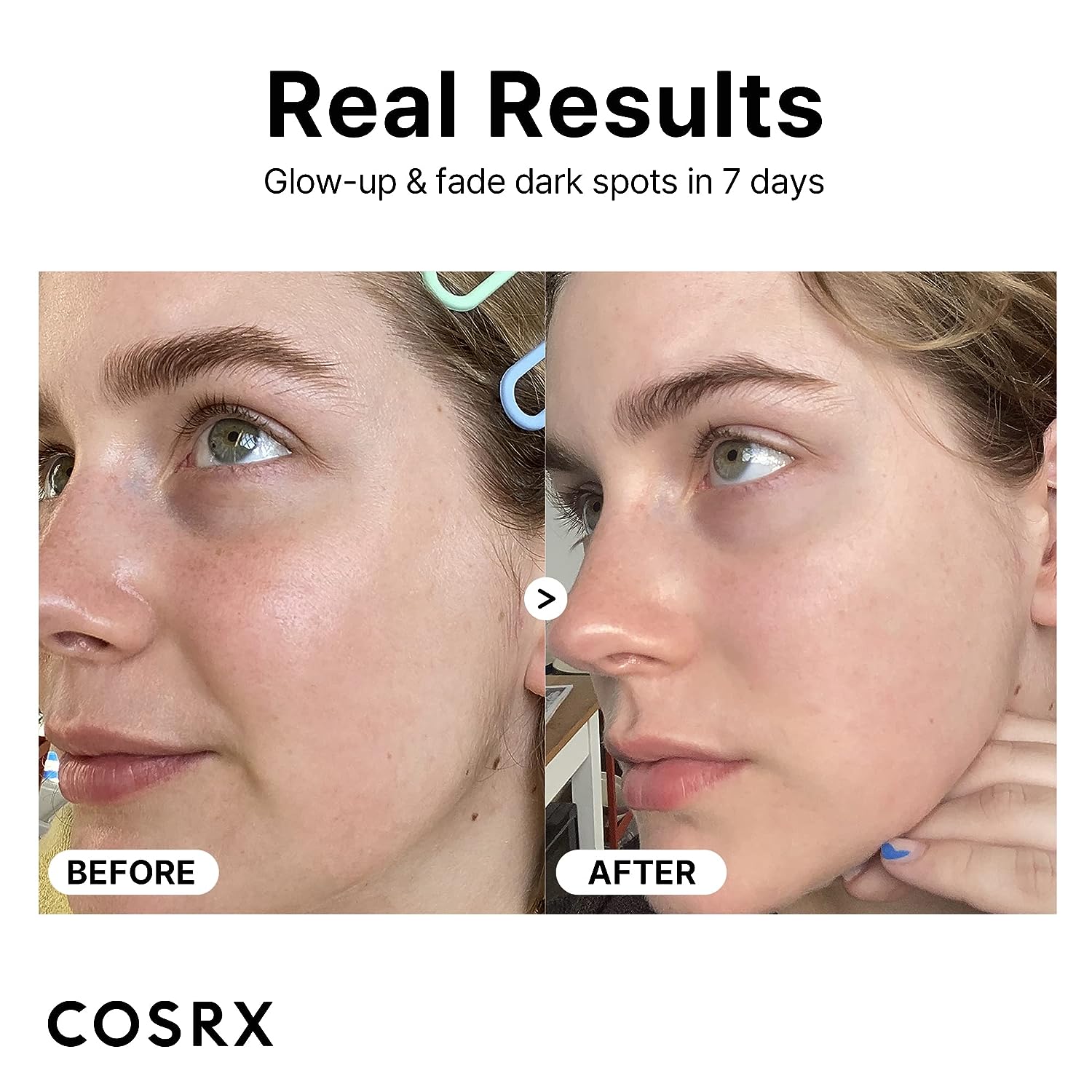 COSRX Pure Vitamin C 23% Serum, 0.67 oz - With Vitamin E & Hyaluronic Acid, Brightens & Hydrates, Reduces Fine Lines, Cruelty - Free - T.E.R